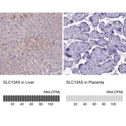 SLC13A5 Antibody, Novus Biologicals 0.1mL; Unlabeled:Antibodies, Polyclonal